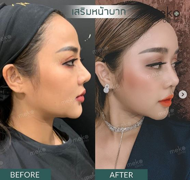 Slider image (2) Thailand Plastic Surgeon - Dr. Oumyos Rattanamahattana